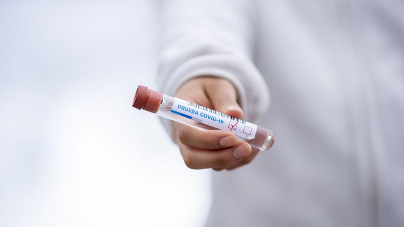 Atsāks valsts apmaksātu Covid-19 testēšanu BIOR laboratorijā