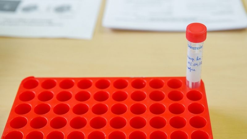Ar Covid-19 saslimuši vēl 11 cilvēki, tostarp arī Piņķu bērnudārzā