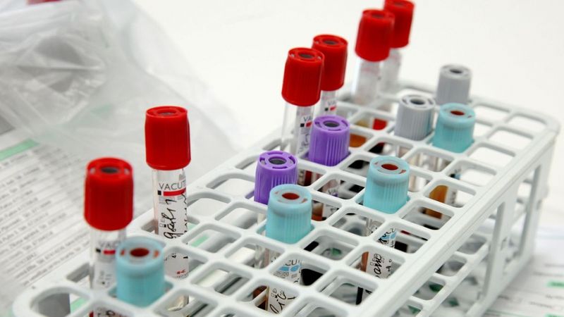 E.Gulbja laboratorijas apgrozījums pērn sarucis par 19%