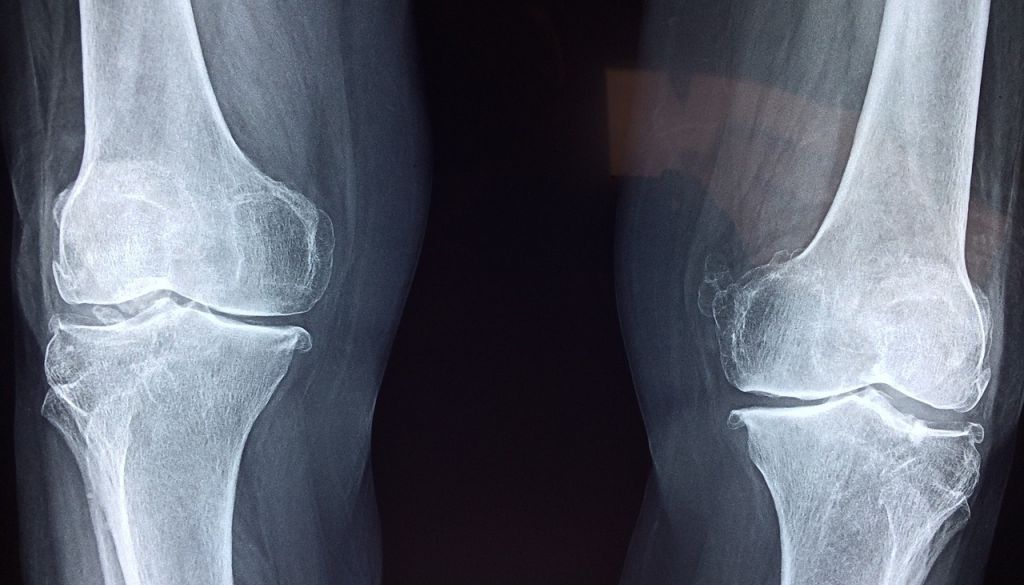 Latvijā medicīnā ieviesīs mākslīgā intelekta asistētu diagnosticēšanu