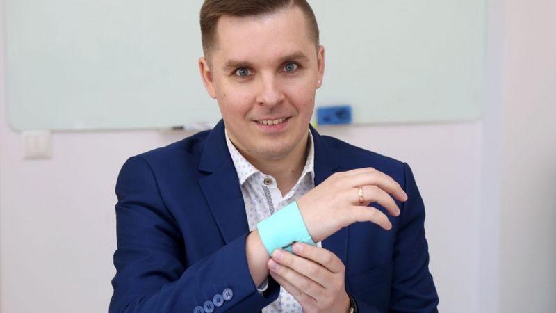 Sākam biznesu: Cīņā ar roku pārslodzi