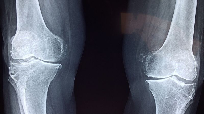Latvijā medicīnā ieviesīs mākslīgā intelekta asistētu diagnosticēšanu