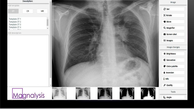 Nāk palīgā radiologiem